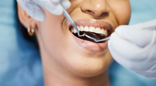 Dental Bonding in East Jordan, MI